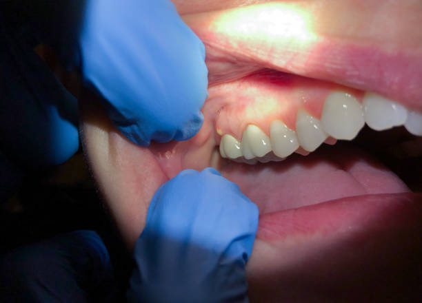 Best Urgent Care for Lost Fillings or Crowns in Levelland, TX